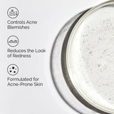 The Ordinary Acne Set (3 pasos)